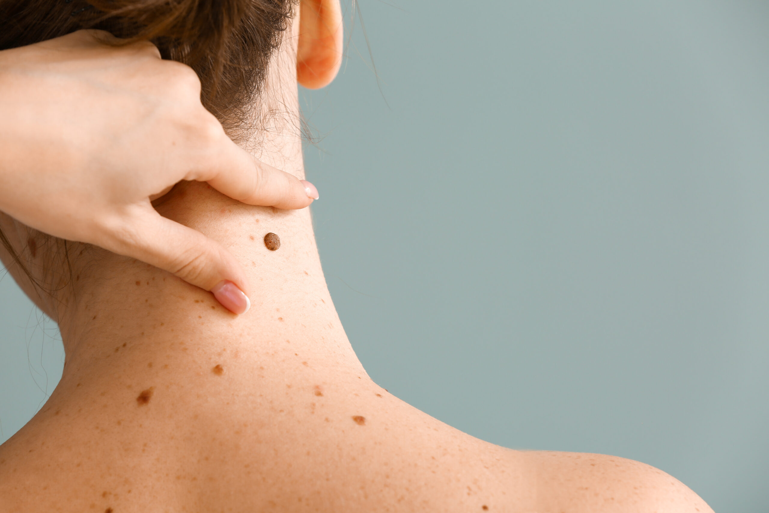 Mole Evaluations